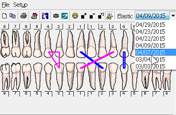 Orthodontic Charting