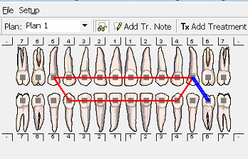 Orthodontic Chart with Elastics